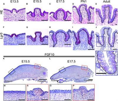 FGF10 Is Required for Circumvallate Papilla Morphogenesis by Maintaining Lgr5 Activity